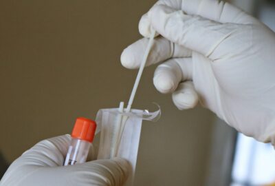 surgical gloved hands holding PCR test