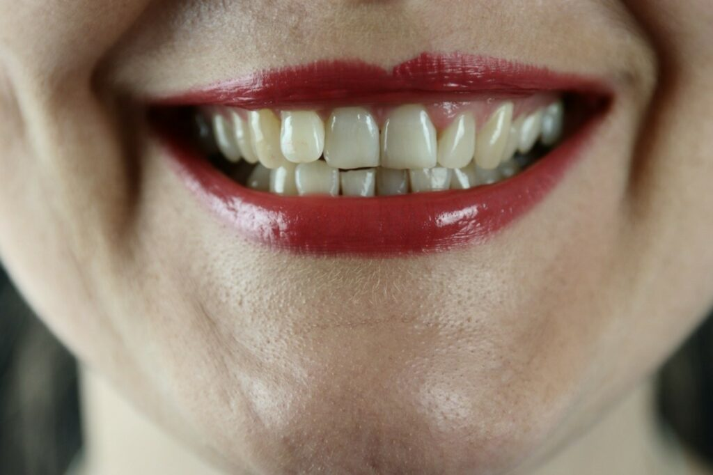 Picture of a smiling face